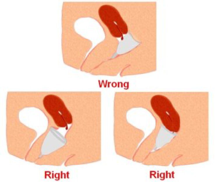 Imagen.8 Cómo colocar la copa menstrual bien puesta